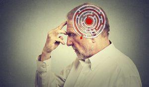 Como proteger o cérebro contra perda de memória - NutriVita